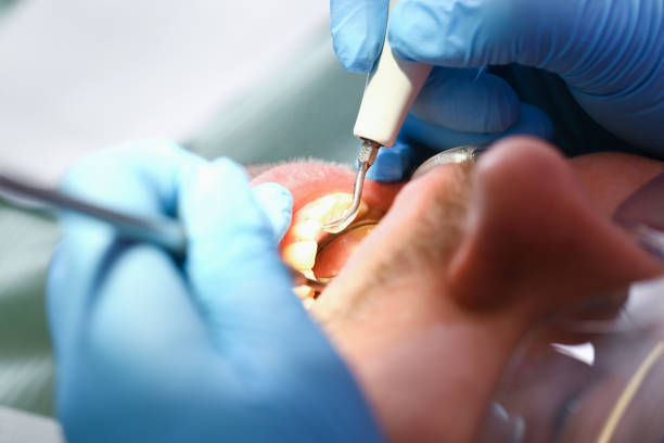 Best Emergency Denture Repair in Rodney Village, DE
